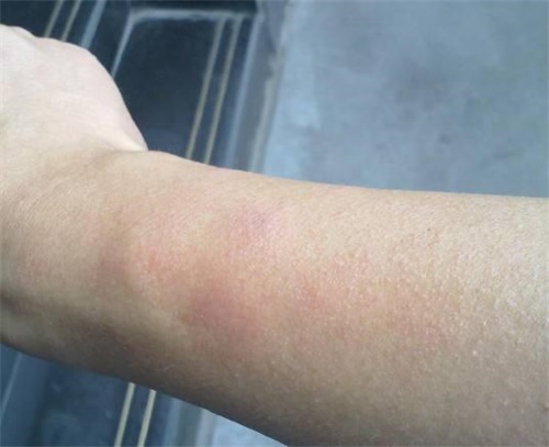 新房入住甲醛超標身體現象